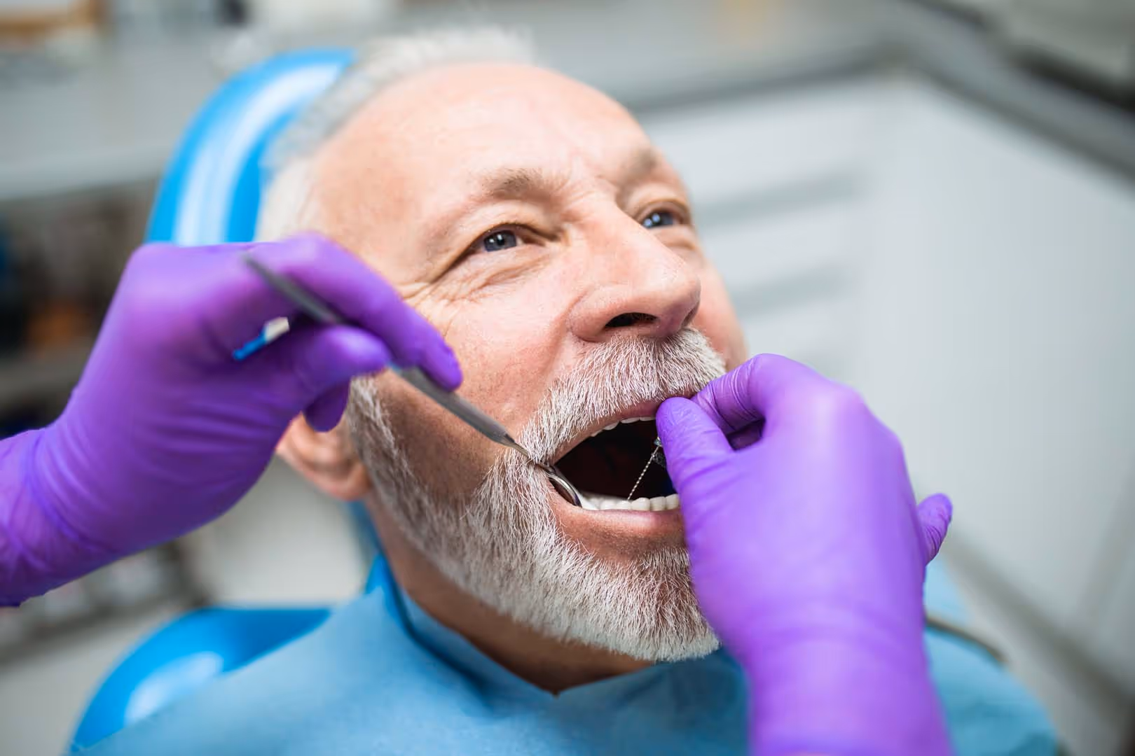 Oral Cancer Screening