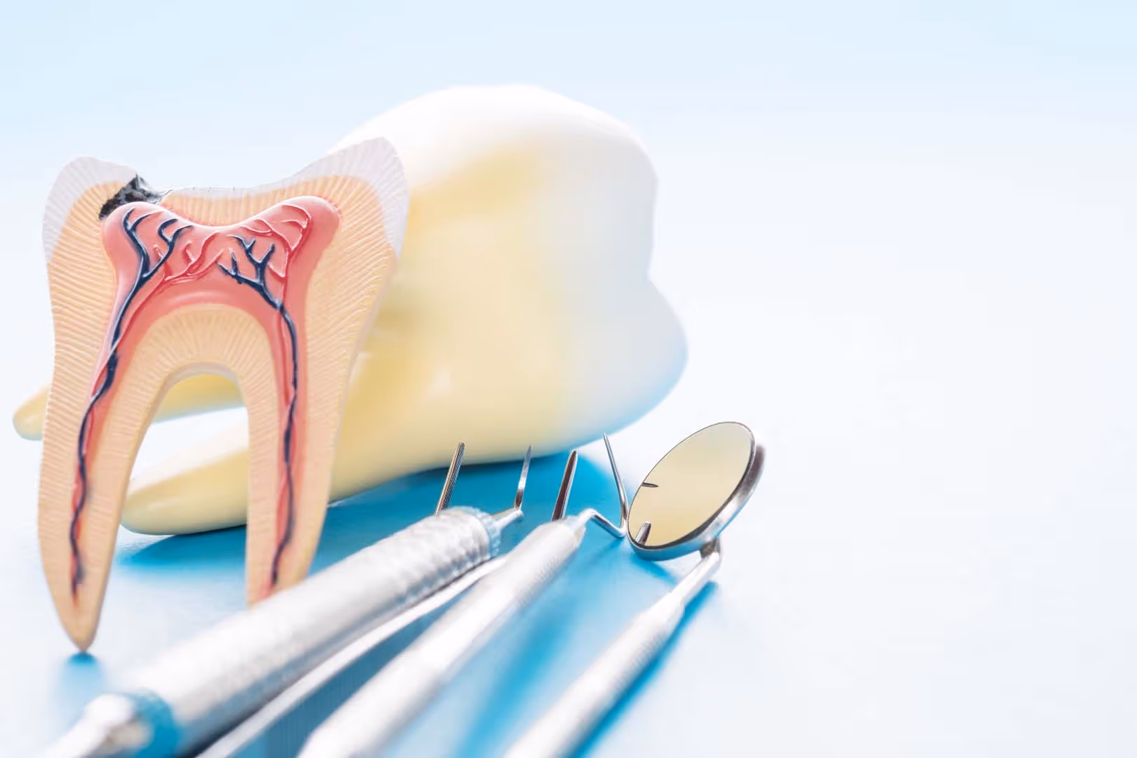 Root Canal Therapy